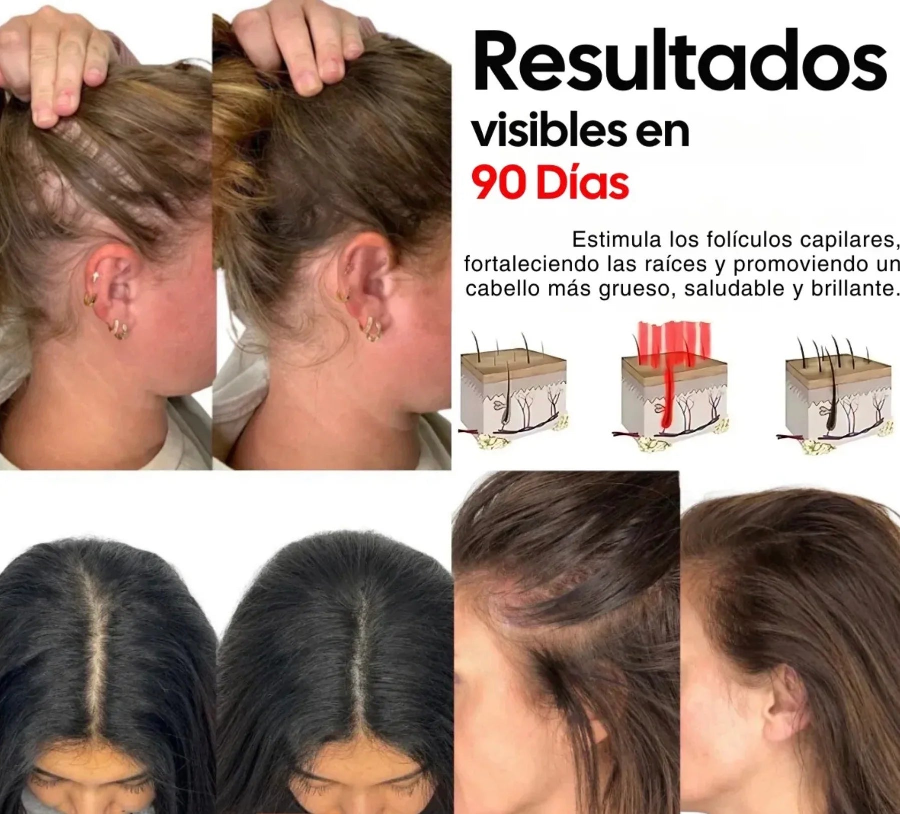 COMBO ACEITE CAPILAR  + CEPILLO TERAPIA CAPILAR (Envío Gratis)