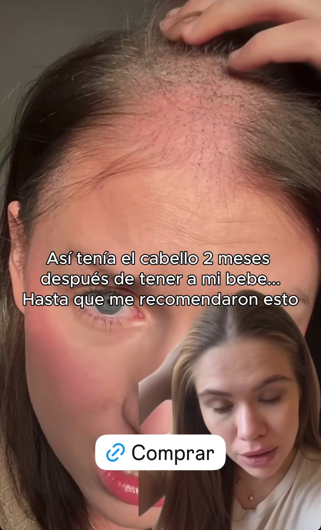 KIT ALTA FRECUENCIA (Envío Gratis)