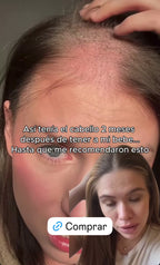 KIT ALTA FRECUENCIA (Envío Gratis)