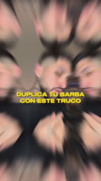 COMBO MINOXIDIL + DERMA ROLLER (Envío Gratis)